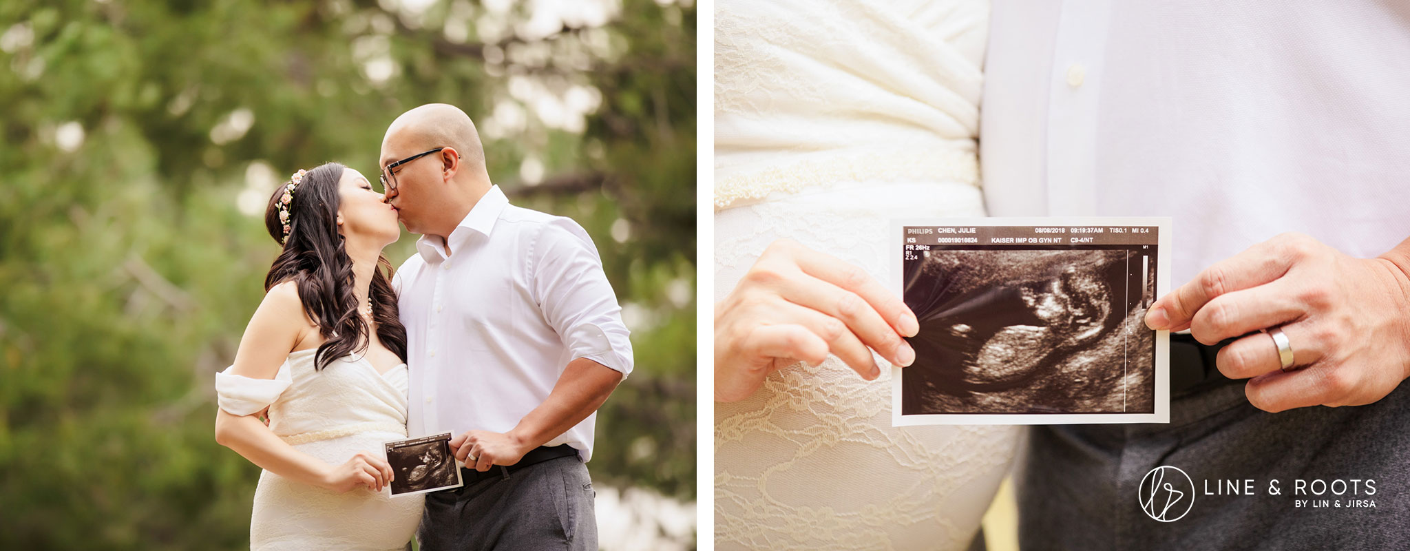 couple maternity photoshoot ideas with medium and close-up angles and props